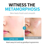 Close-up of skin before-and-after from amino acid face cleanser treatment