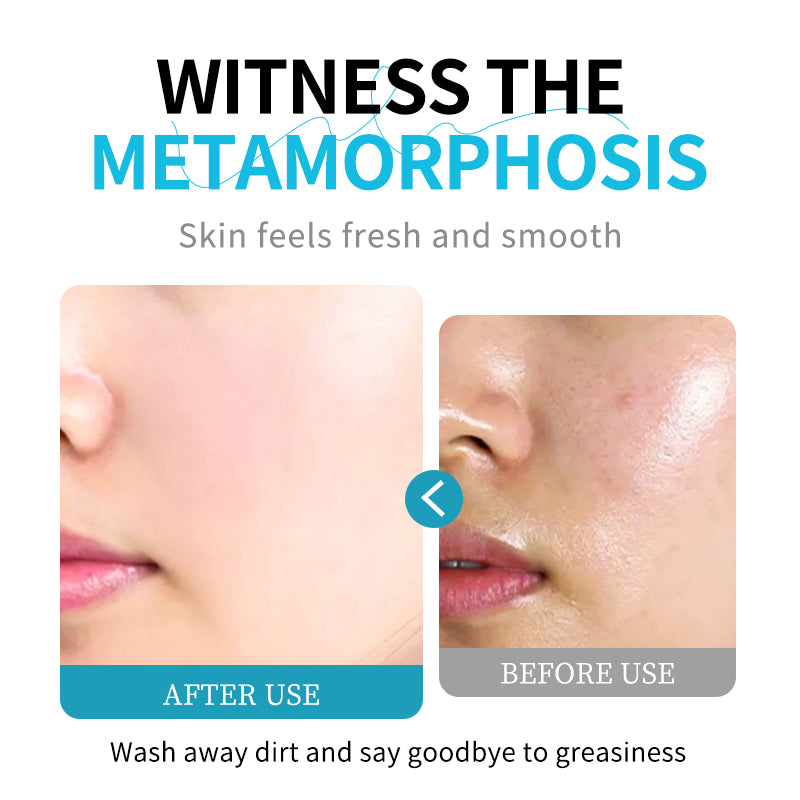 Close-up of skin before-and-after from amino acid face cleanser treatment